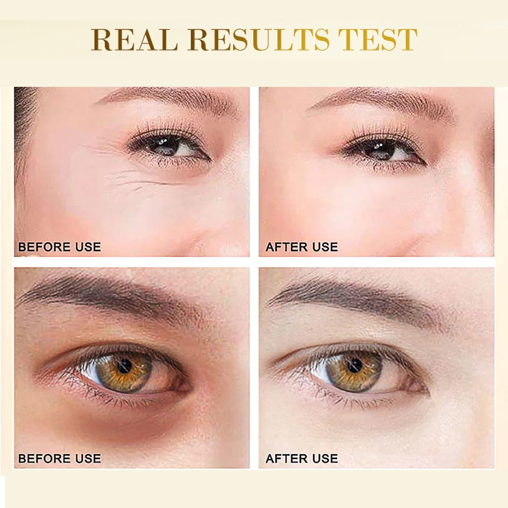 Tratamiento para ojos de ácido hialurónico de oro eliminador de ojeras, Parches de colágeno para los ojos